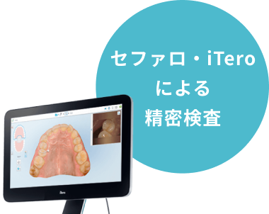 セファロ・iTeroによる精密検査